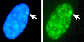 File:BarrBodyBMC Biology2-21-Fig1clip293px.jpg