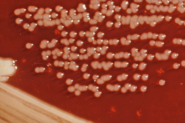File:Yersinia enterocolitica 01.png