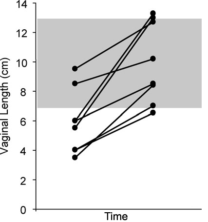 File:Results of vaginal lengthening by pressure dilation methods.jpg