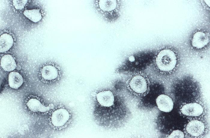 File:TEM of coronavirus OC43.jpg