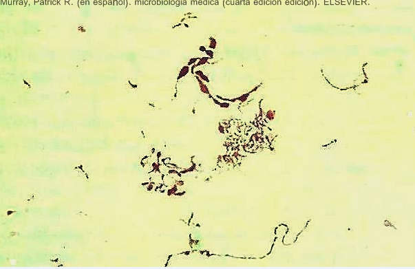 File:Streptobacillus moniliformis.png