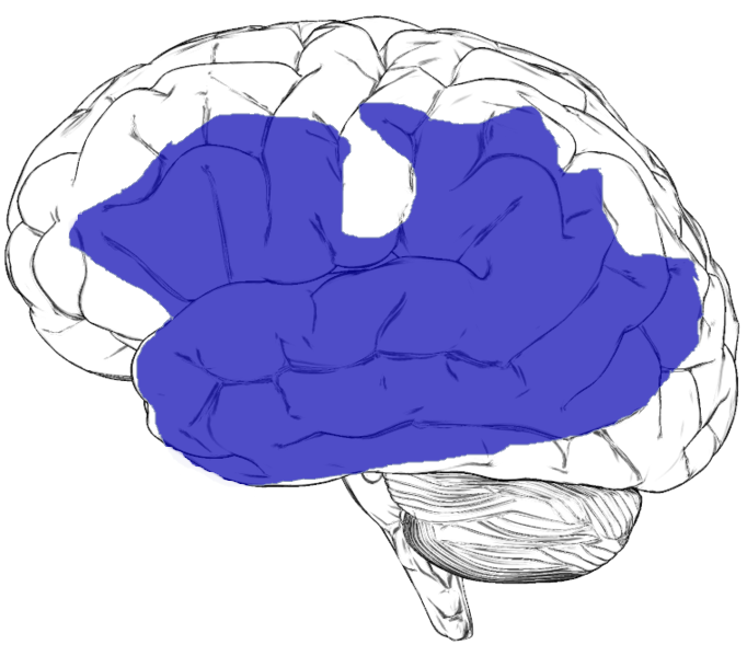 File:Aphasia.png