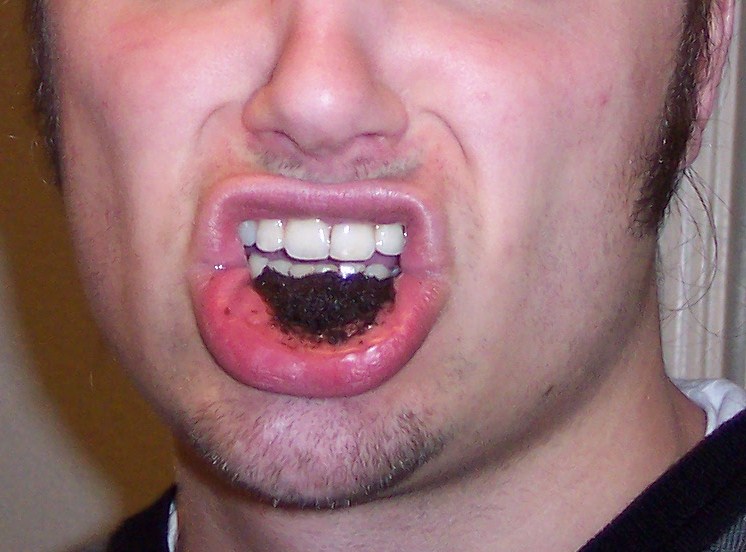 File:Dipping tobacco in mouth.jpg