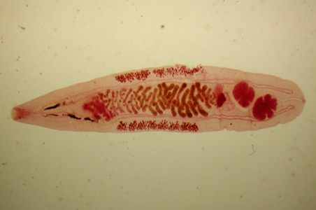 File:Opisthorchis felineus Korea.jpg