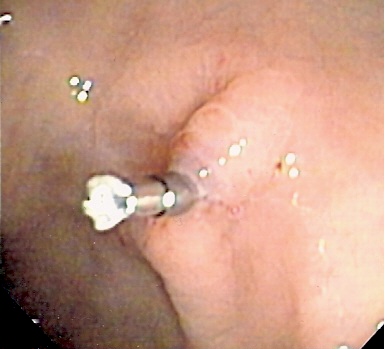 File:GU with clip.jpg