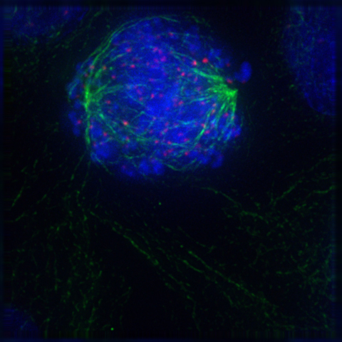 File:Prometaphase.jpg