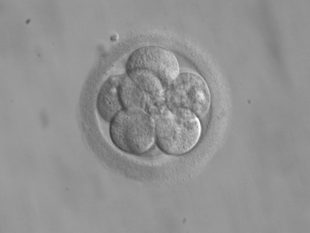 File:Embryo, 8 cells.jpg