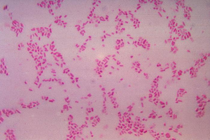 File:BacteroidesFragilis Gram.jpg