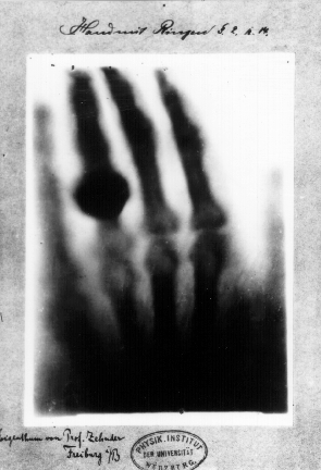 File:Anna Berthe Roentgen.gif