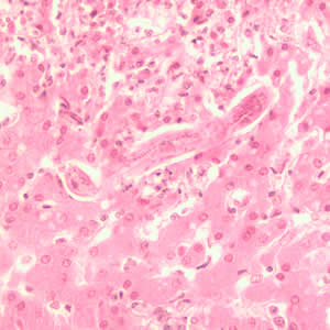 File:Toxocara larva2 h&e.jpg