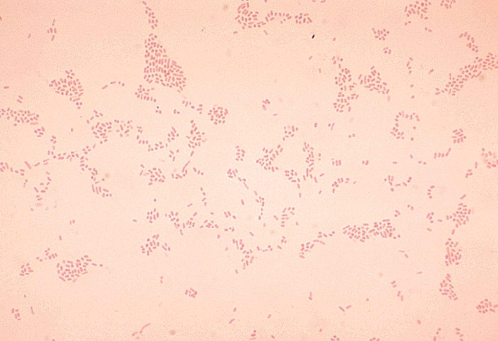 File:Actinobacillus suis.jpg