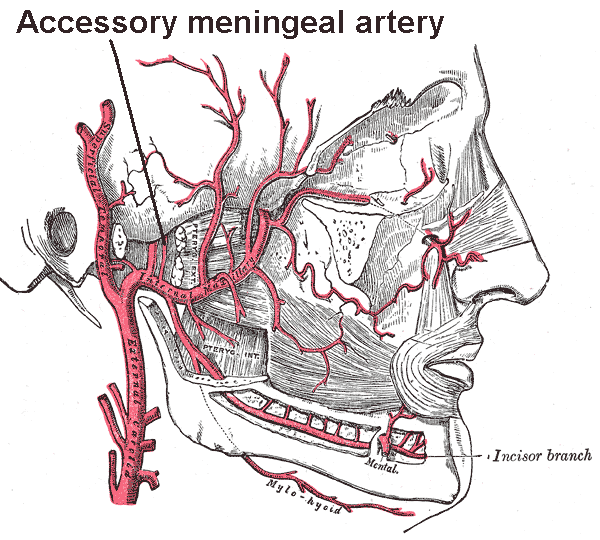 File:Assessory meningeal artery.png