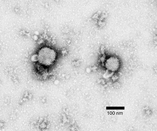 File:Lymphocytic choriomeningitis virus.jpg
