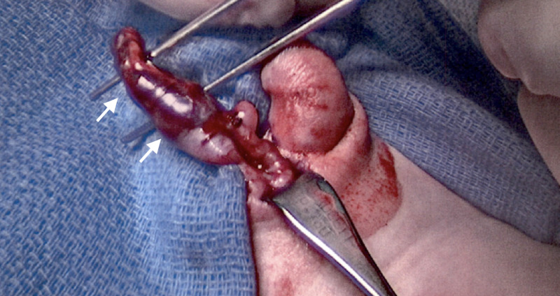 File:Cureus-0012-00000009017-i03.jpg