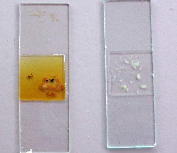File:Stool iodine and saline wet mount.jpg