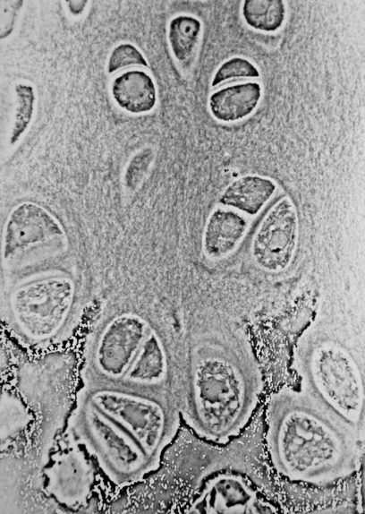 File:Hypertrophic Zone of Epiphyseal Plate.jpg