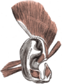 Otoplasty