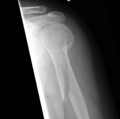 Thumbnail for version as of 22:35, 8 June 2026