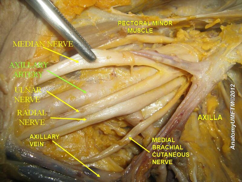 File:Slide2bbbb.JPG