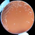 Haemophilus