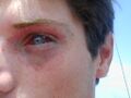 Diving safety