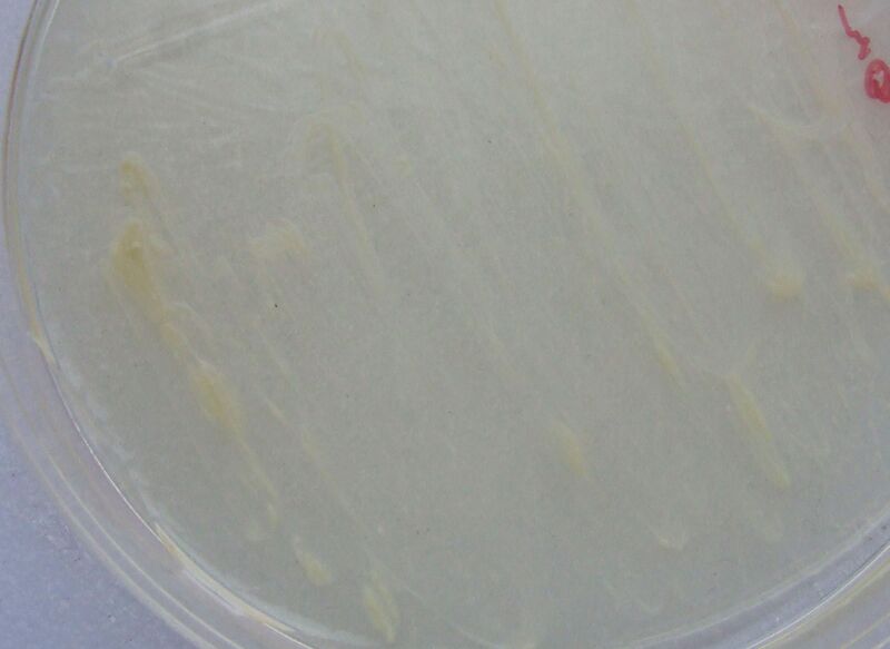 File:Mycobacterium abscessus.jpg