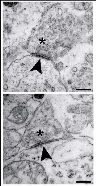 File:Postsynaptic density.jpg