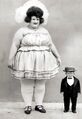 Obese woman