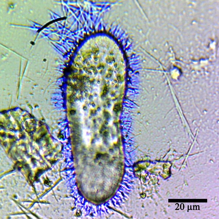 File:Trichocyst.jpg