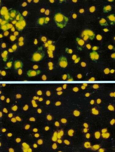File:Virus Infected Cells.jpg