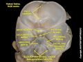 Vestibulocochlear nerve