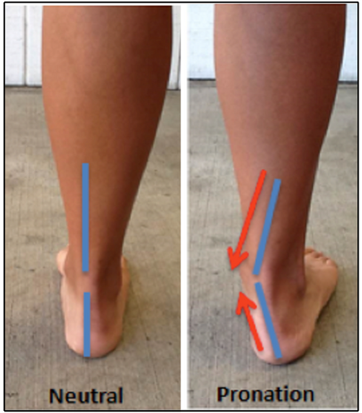 File:Ankle Pronation Position.png