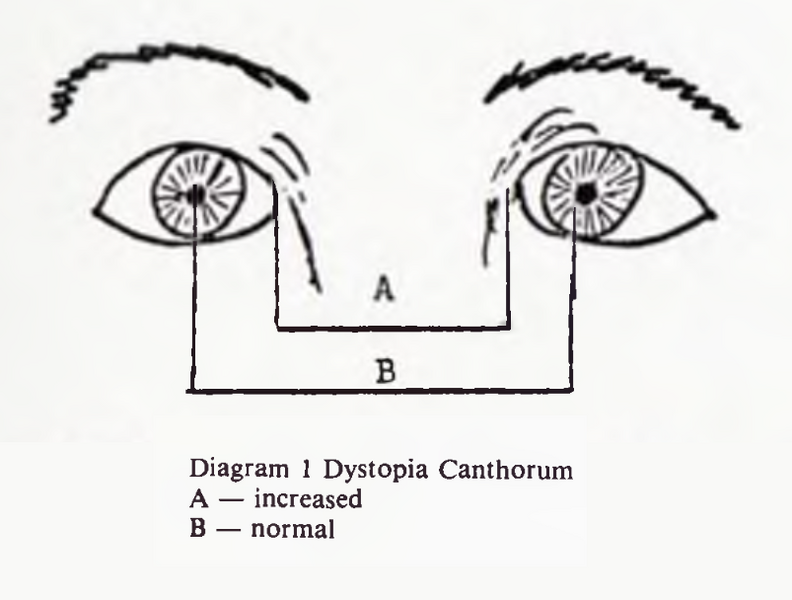 File:Dystopia canthorum diagram.png