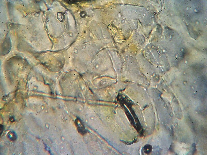 File:Rust attacking stoma.jpg