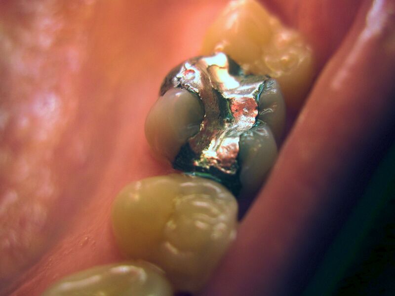 File:Filling.jpg
