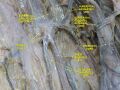 Great saphenous vein in a clinical slide