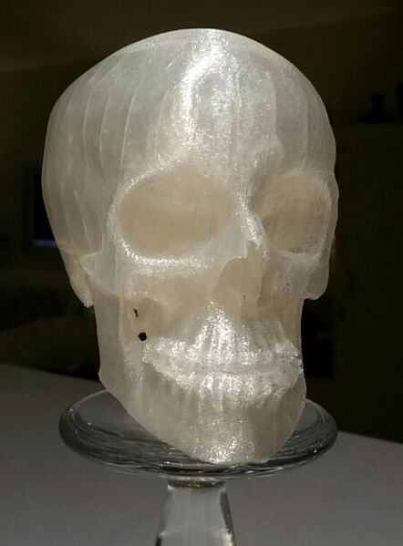 File:3D Printed Macrognathism.jpg