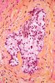 HPS stain