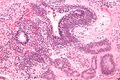 Thumbnail for version as of 03:34, 5 June 2026
