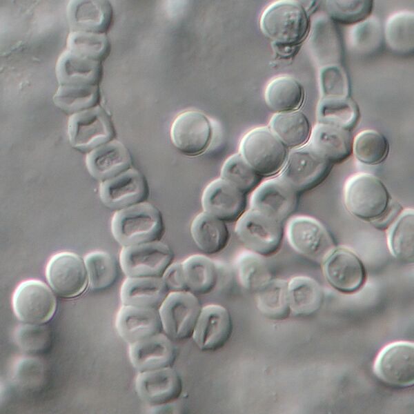 File:Trichophyton verrucosum chlamydospores.jpg