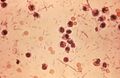 Shigella stool