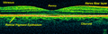 Retina