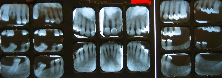 File:Dental Radiography.JPG