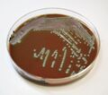 Chocolate agar