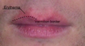 Thumbnail for version as of 13:41, 8 June 2026