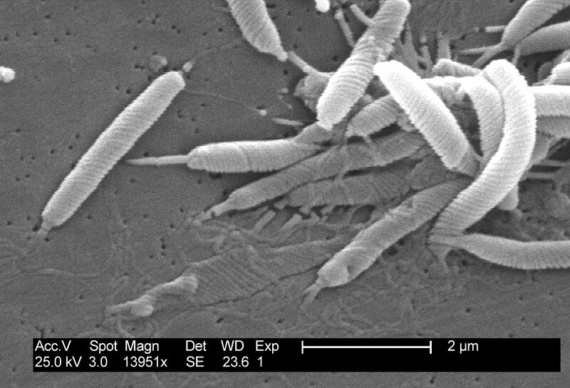 File:Helicobacter sp 01.jpg
