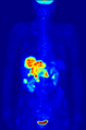 Ligand binding assay