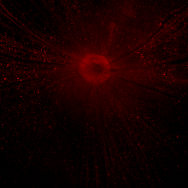 File:50x RGC axotomy 1 day.png