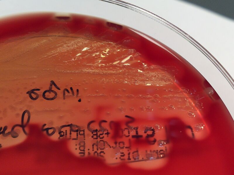 File:Streptococcus equi.jpg