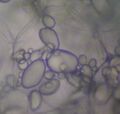Amyloplasts in potato cells